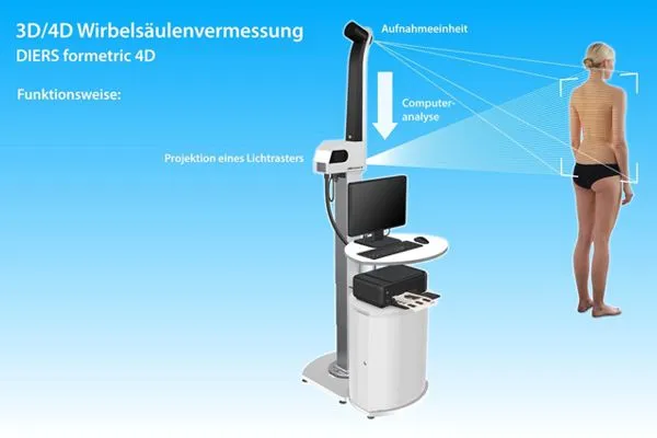 Wirbelsäulenvermessung